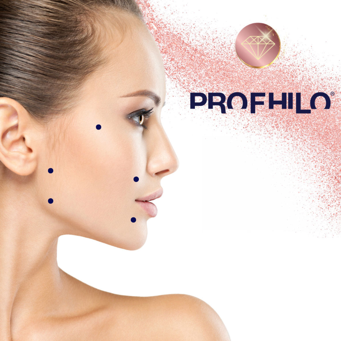 Profhilo